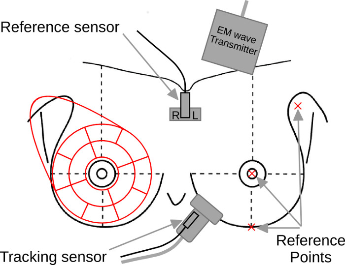 Software for Monitoring Coverage in Hand-Held Whole-Breast Ultrasound