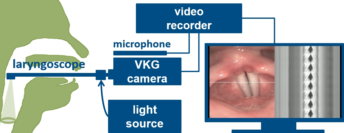 Scheme of the data acquisition